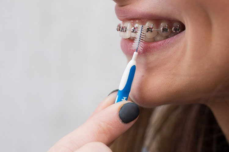 مسواک‌های بین دندانی (اینترپروگزیمال)